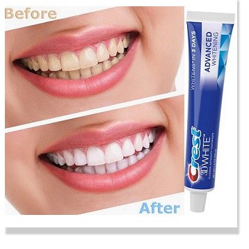 [Mã chiết khấu giảm giá mỹ phẩm sỉ chính hãng] Kem Đánh Răng Crest 3D White Advanced Whitening 158g