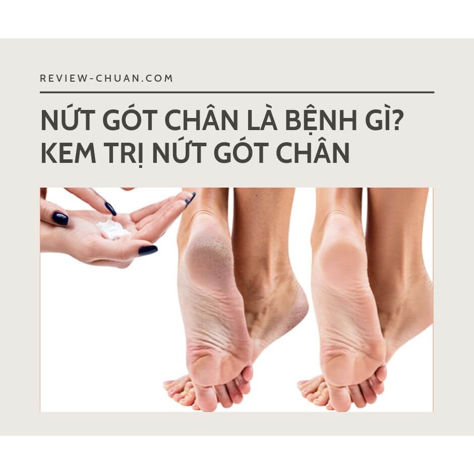 [Chính hãng] Kem Dưỡng Trị Nứt Gót Chân Neutrogena Foot Cream 56g