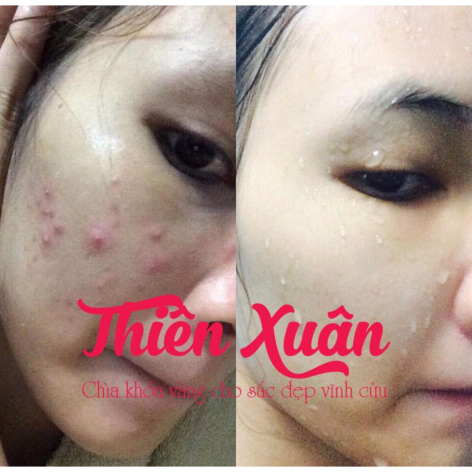 Thiên Xuân Bột Uống Trắng Da Thần Tốc Chính Hãng_tặng kèm safron