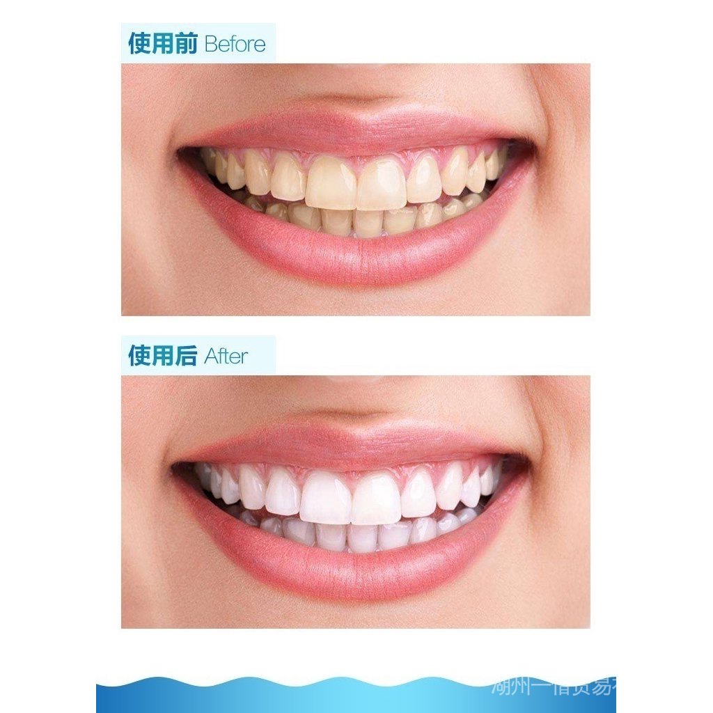 Thiết bị chiếu đèn led làm trắng răng teeth hiệu quả cao