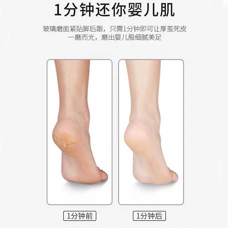 Dụng Cụ Chà Gót Chân Loại Bỏ Vết Chai Da Chết Tiện Dụng