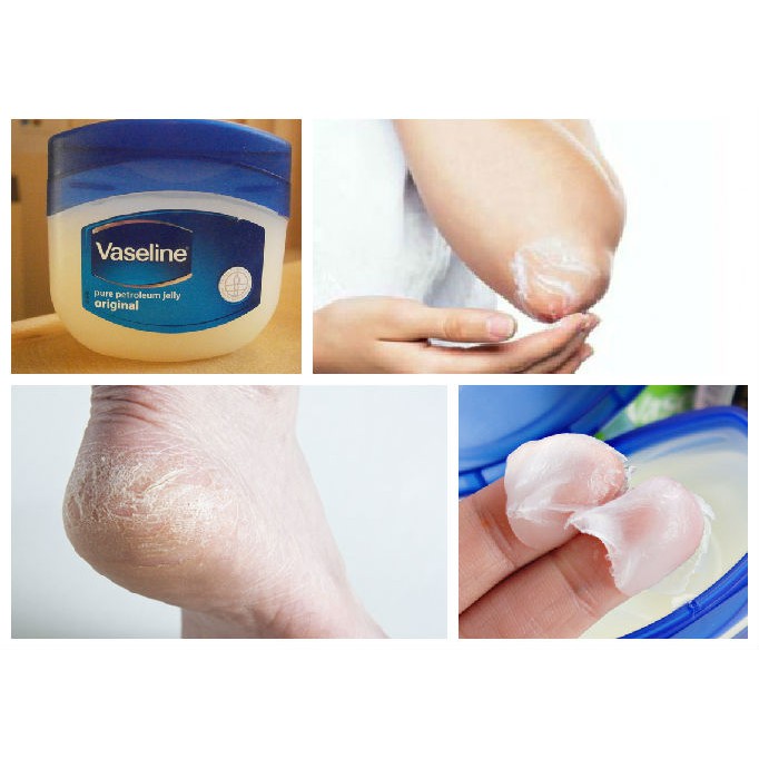 Sáp dưỡng ẩm Vaseline 100% Pure Petroleum jelly Original