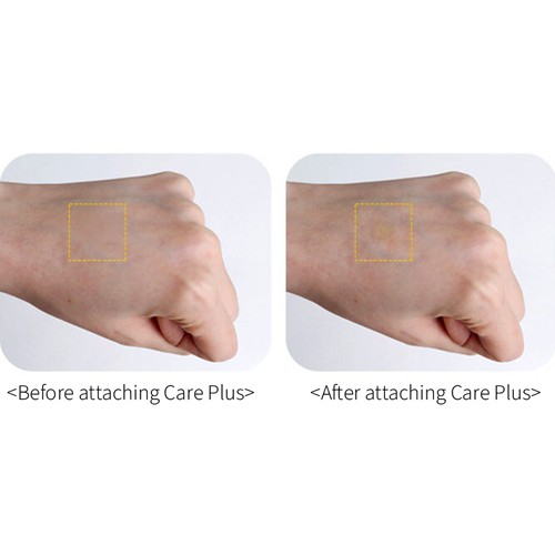 Miếng dán sẹo mụn thành phần mật ong che khuyết điểm chăm sóc da