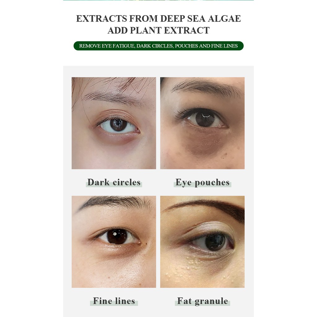 Set 30 cặp mặt nạ mắt rong biển Fenyi làm săn chắc da loại bỏ quầng thâm và bọng mắt