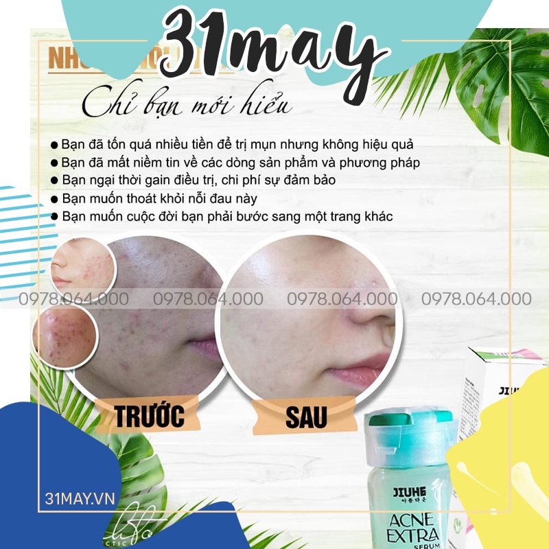 Serum Mụn Jiuhe Acne Extra 5ml Thanh Tô Chính Hãng