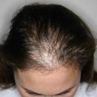 Dầu gội đầu Mộc Mây
