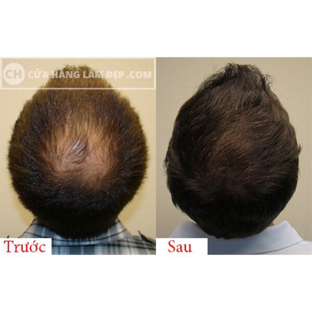 Thuốc bôi kích thích mọc tóc Sato Nhật Bản | BigBuy360 - bigbuy360.vn