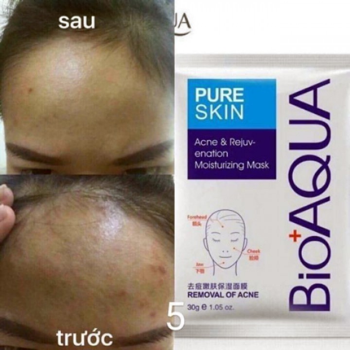 Mặt nạ bạc dùng cho da mụn đỏ mask Pure Skin Bioaqua - gói 30g