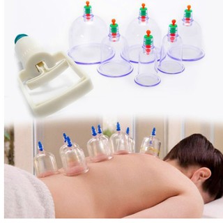 BỘ GIÁC HƠI 12 ỐNG HÚT CHÂN KHÔNG