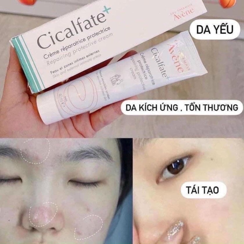 kem dưỡng avene phục hồi