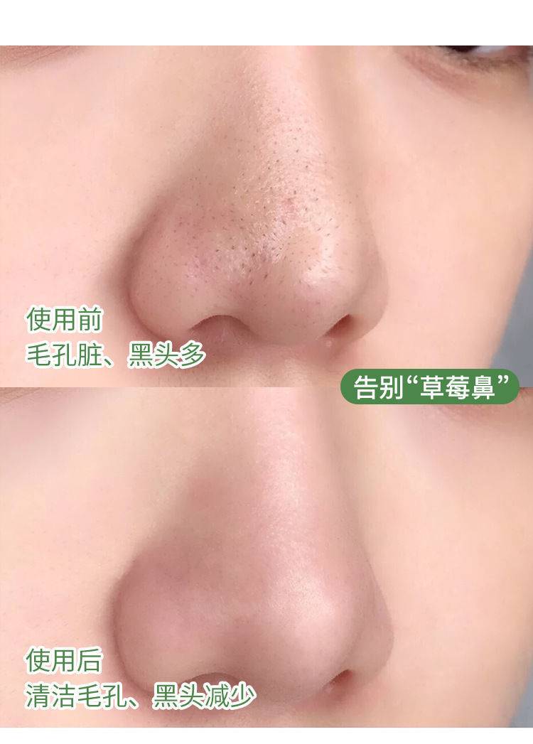 (Hàng Mới Về) Mặt Nạ Bùn Trà Xanh Làm Sạch Mụn Đầu Đen Kiểm Soát Dầu Hiệu Pinki 40g | BigBuy360 - bigbuy360.vn