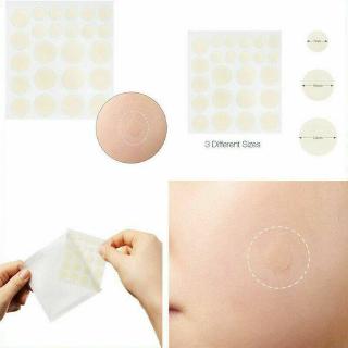 Bộ 24 Miếng Dán Mụn Hydrocolloid Chăm Sóc Da