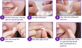MIẾNG DÁN MỤN MAYAN CARE ULTRA THIS SPOT ACNE PATCH (Hộp 20+4 miếng)