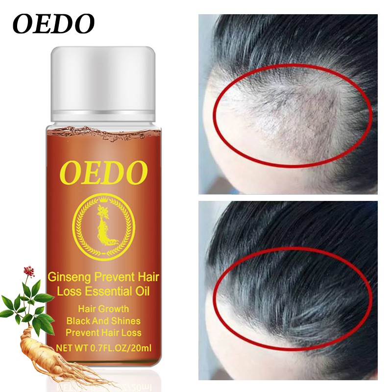 Dung dịch dưỡng tóc OEDO có thành phần nhân sâm ngăn ngừa rụng tóc giúp mọc và phục hồi tóc hư tổn