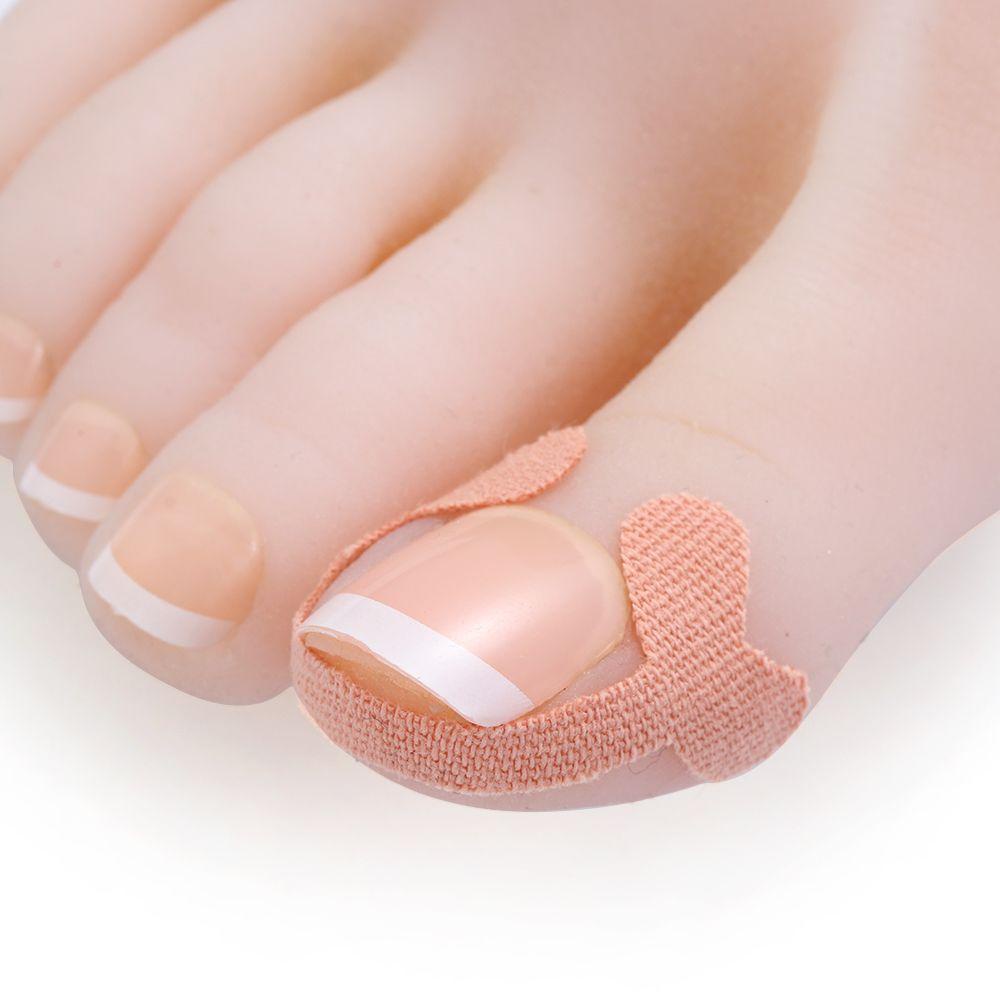 Miếng Dán Chỉnh Hình Chăm Sóc Móng Chân Chuyên Nghiệp
