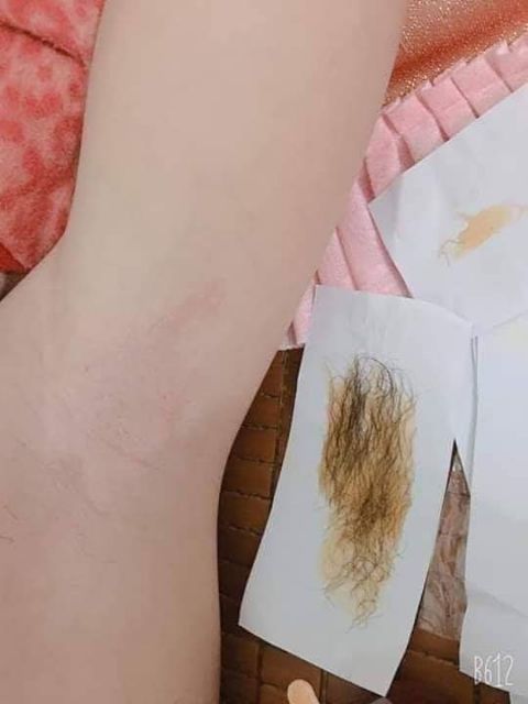 Combo wax tẩy lông vĩnh viễn (Handmade) | BigBuy360 - bigbuy360.vn