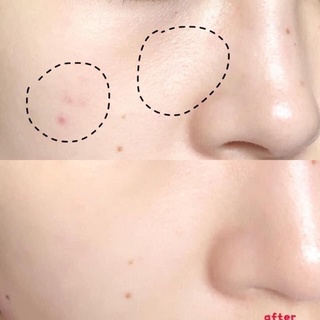 (Mã NSF020280 giảm 80K) Serum AHC Sale Cực Khủng