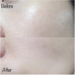 Mặt Nạ Thạch sinh học Celderma Ninetalks Hydrogel Mask