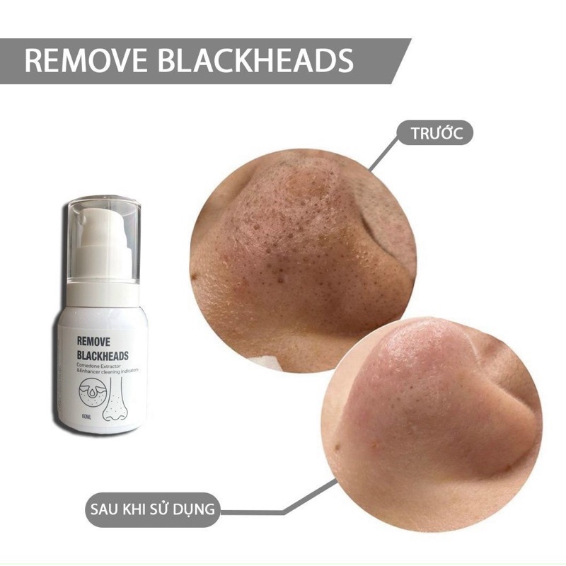 Ủ MỤN REMOVES BLACKHEAD CHUYÊN DÙNG TRONG SPA