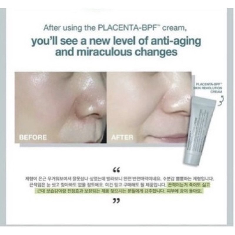 Kem Nhau Thai Phục Hồi Da Placenta - BPF Skin Revolution Cream