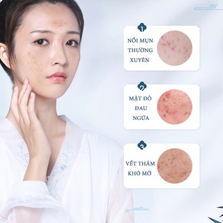SERUM TRỊ THÂM MỤN SOONPURE  30ML