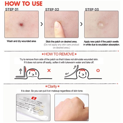 Miếng dán mụn Cosrx Acne Pimple Master Patch (Đỏ) / Cosrx Clear Fit Master Patch (Đen)