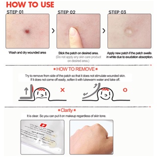 Miếng dán mụn Cosrx Acne Pimple Master Patch (Đỏ) / Cosrx Clear Fit Master Patch (Đen) - Ellyshop176