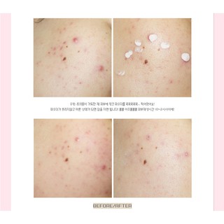 DATE 04/25 Dung Dịch Chấm Mụn Ciracle Red Spot Pink Powder 16ml