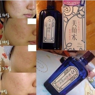 Toner BINGASUI MEISHOKU Nhật Bản