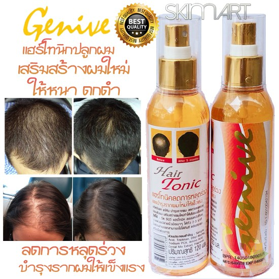 Chai xit ƙích mọc ṫóc Genive Hair Tonic Thái Lan