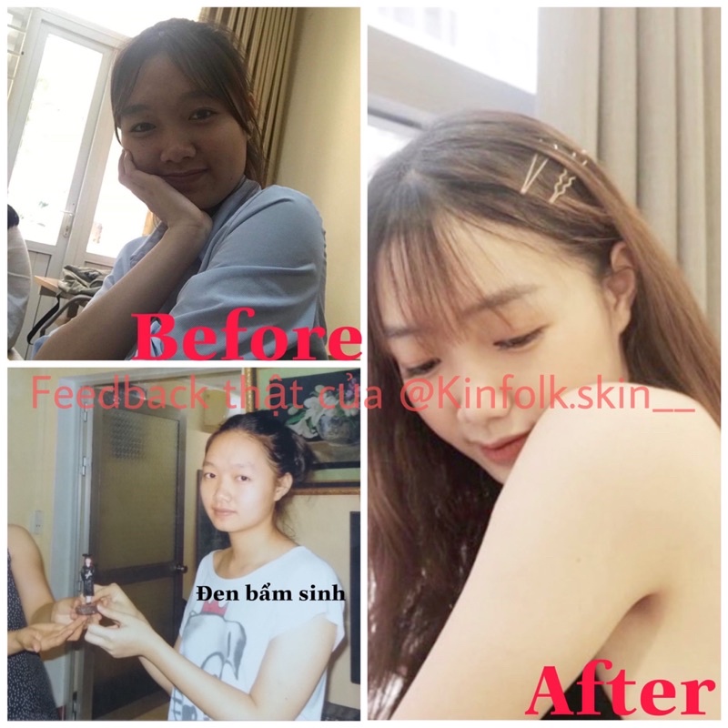 [SALE] Combo Dưỡng Trắng Da Body An Toàn | BigBuy360 - bigbuy360.vn