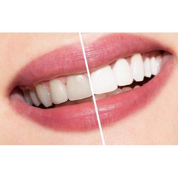 Kem Đánh Răng Baking Soda