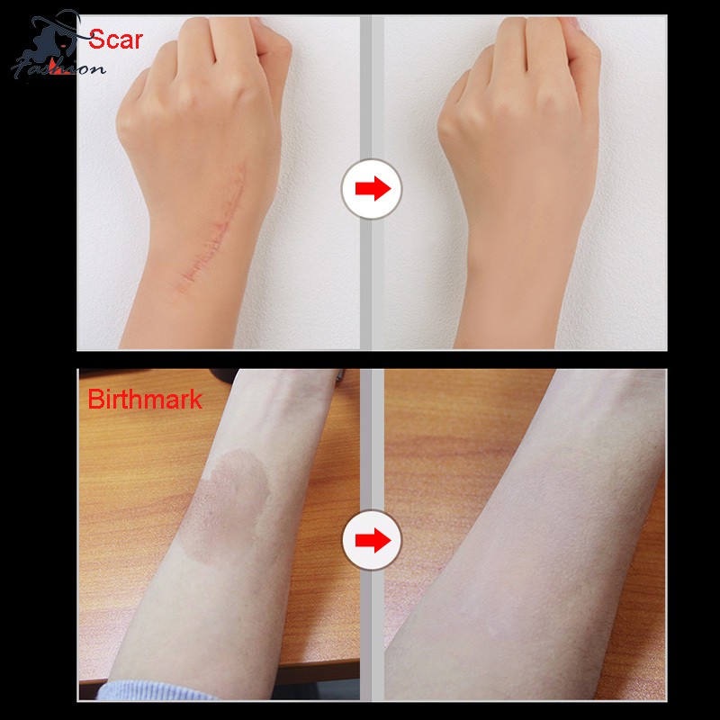 Bộ 2 kem che khuyết điểm/sẹo/hình xăm/vết bớt không gây đau đớn | BigBuy360 - bigbuy360.vn