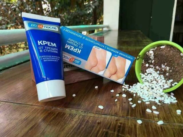 Kem trị nứt nẻ chân Nga BQ | BigBuy360 - bigbuy360.vn