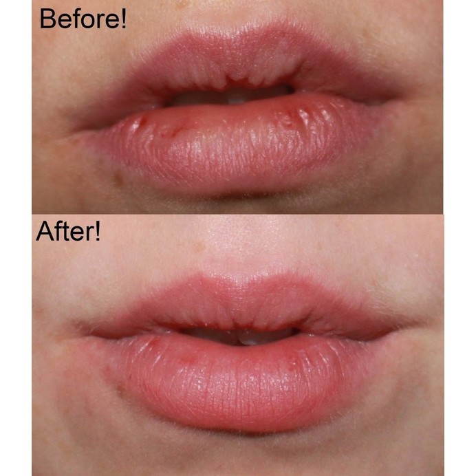 Tẩy tế bào chết, làm hồng môi Lip Scrun Aha 5g - PN