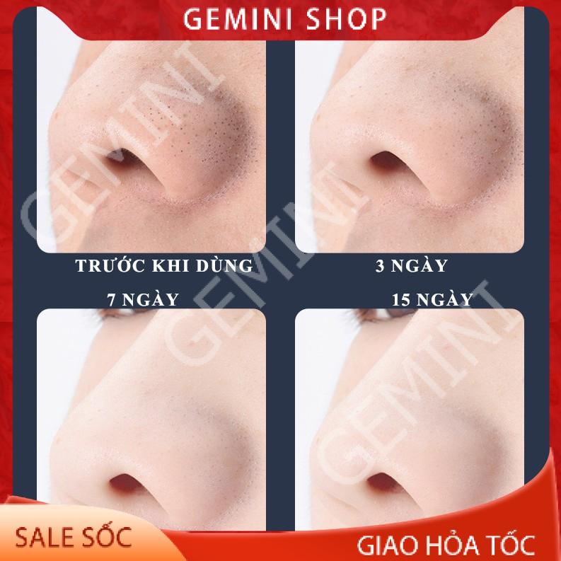 MÁY HÚT MỤN 8001 cầm tay CAO CẤP 5 lực hút mạnh nhiều đầu hút GEMINI SHOP