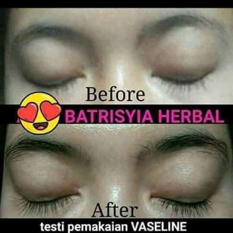 Vaseline (Hàng Mới Về) Kem Dưỡng Da Chân / Gót Chân / Gót Chân Dày Mượt Mà Chống Gãy Rụng