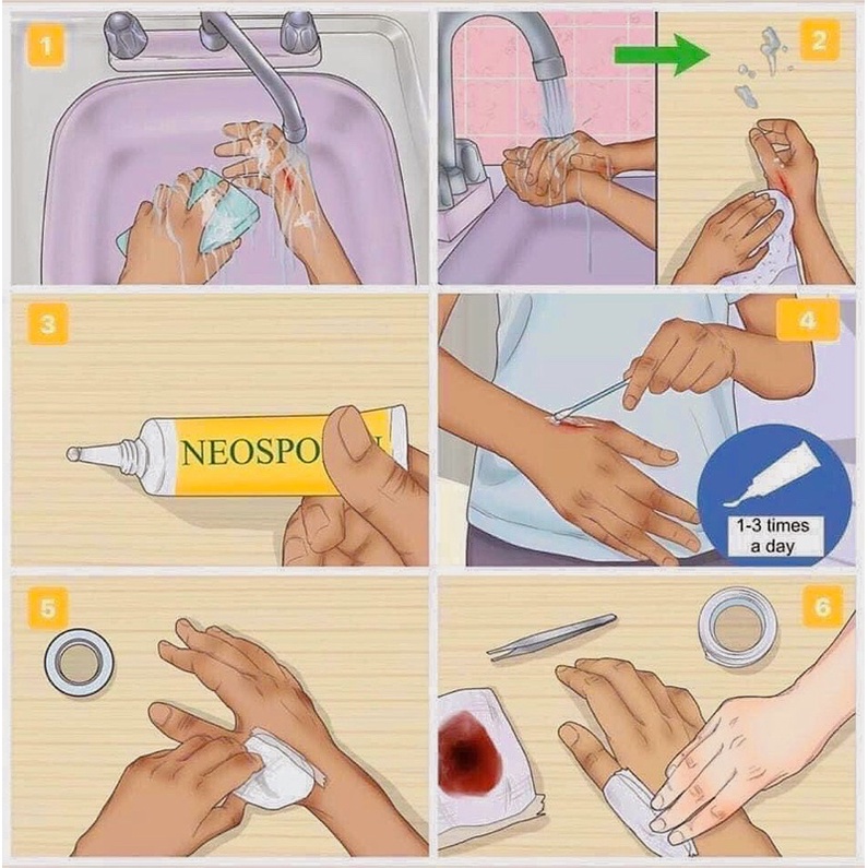 Neosporin lành vết thương hở, vết bỏng vết cắn Neosporin Pain Relief Ointment 56.7g Mỹ Date Mới Nhất