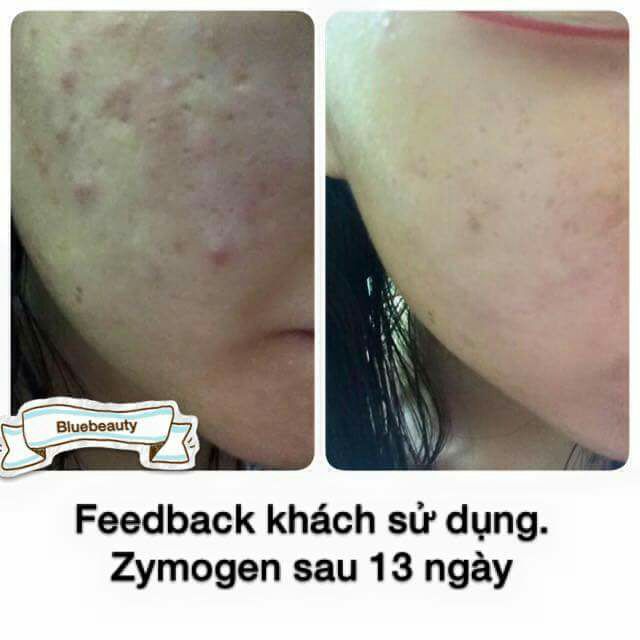 [Nội Địa Hàn] Bộ Loại Bỏ Mụn Ngừa Thâm Lành Sẹo ZYMOGEN Houttuynia Cordata Ferment Serum và Centella Cream | BigBuy360 - bigbuy360.vn