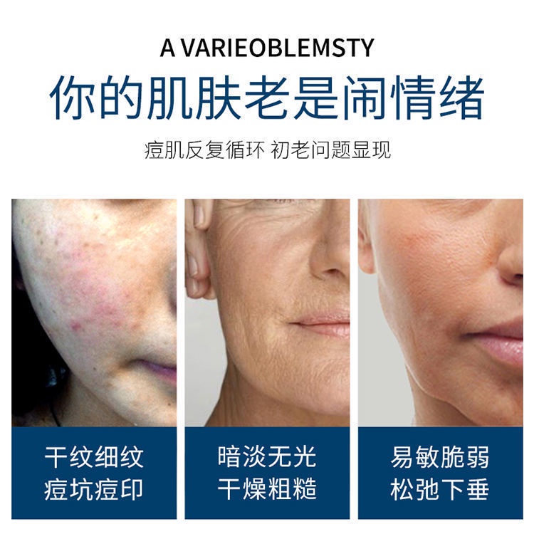 Ehrlich tinh chất oligopeptide phục hồi làm trắng da hỗ trợ giảm mụn dưỡng ẩm làm trắng da | BigBuy360 - bigbuy360.vn