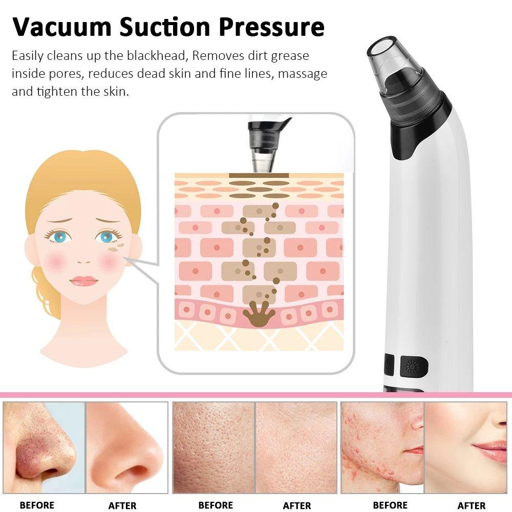 Máy Hút Mụn Đầu Đen Làm Sạch Sâu Cho Mũi
