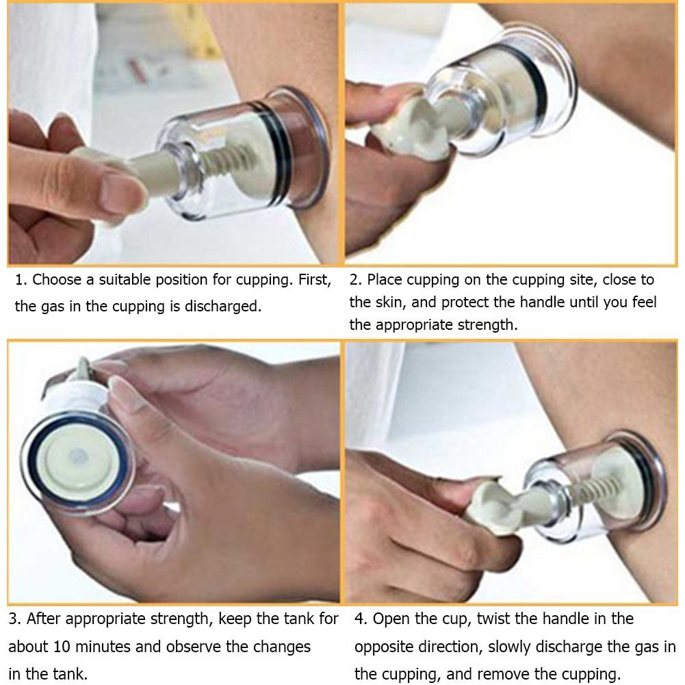 Cốc Giác Hơi Hút Chân Không