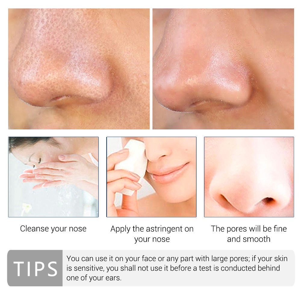 Tinh chất Lanbena se khít lỗ chân lông hiệu quả 15ml