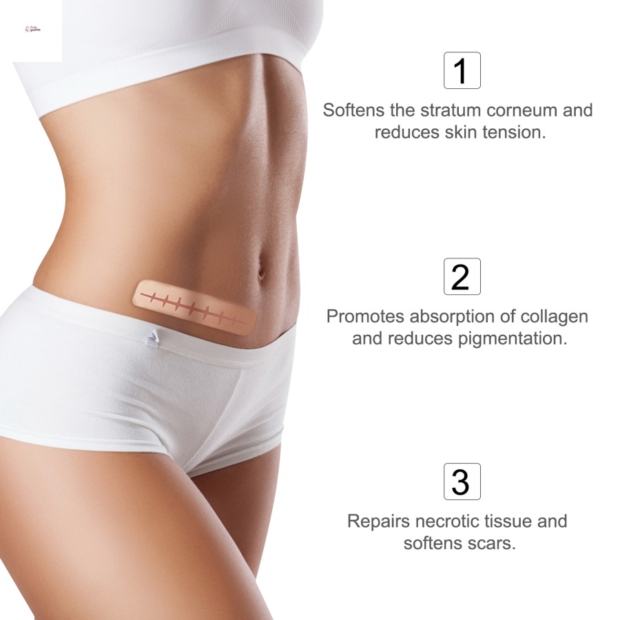 Miếng dán xóa mờ sẹo bằng gel silicone tái sử dụng ALIVER