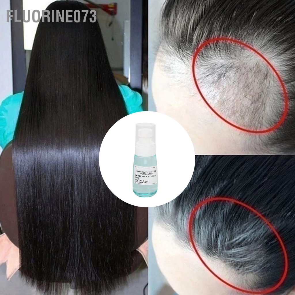 [Hàng Sẵn] 70ml Thuốc Xịt Mọc Tóc Nhanh Làm Dày Da Đầu Điều Trị Cho Nam Và Nữ 【Fluorine073】