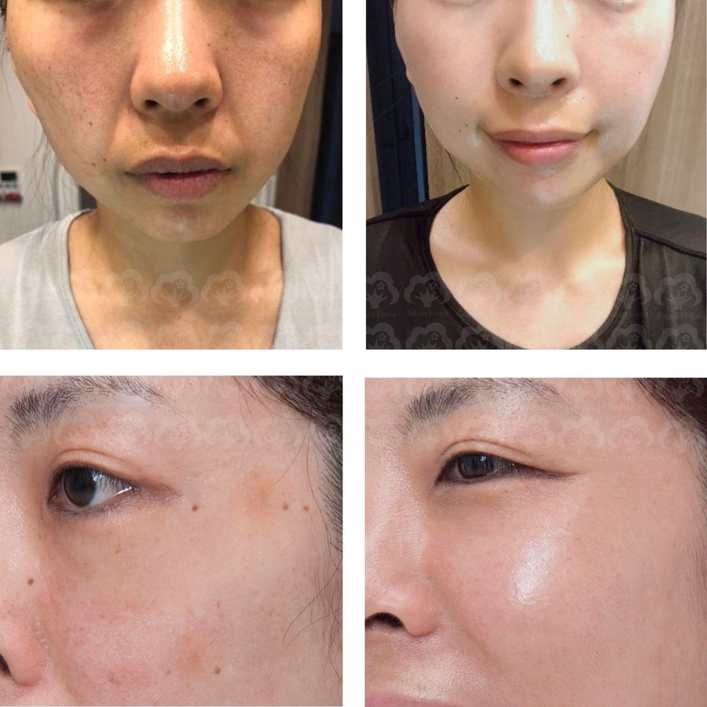 Kem Dưỡng Trắng Da Glaskin Dưỡng Trắng Mờ Thâm Nám