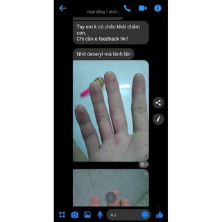 Kem dưỡng dexeryl nội địa Pháp