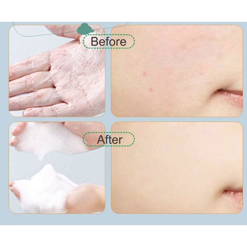 Lưới tạo bọt sửa rửa mặt làm sạch da, giảm kích ứng da khi rửa mặt.
