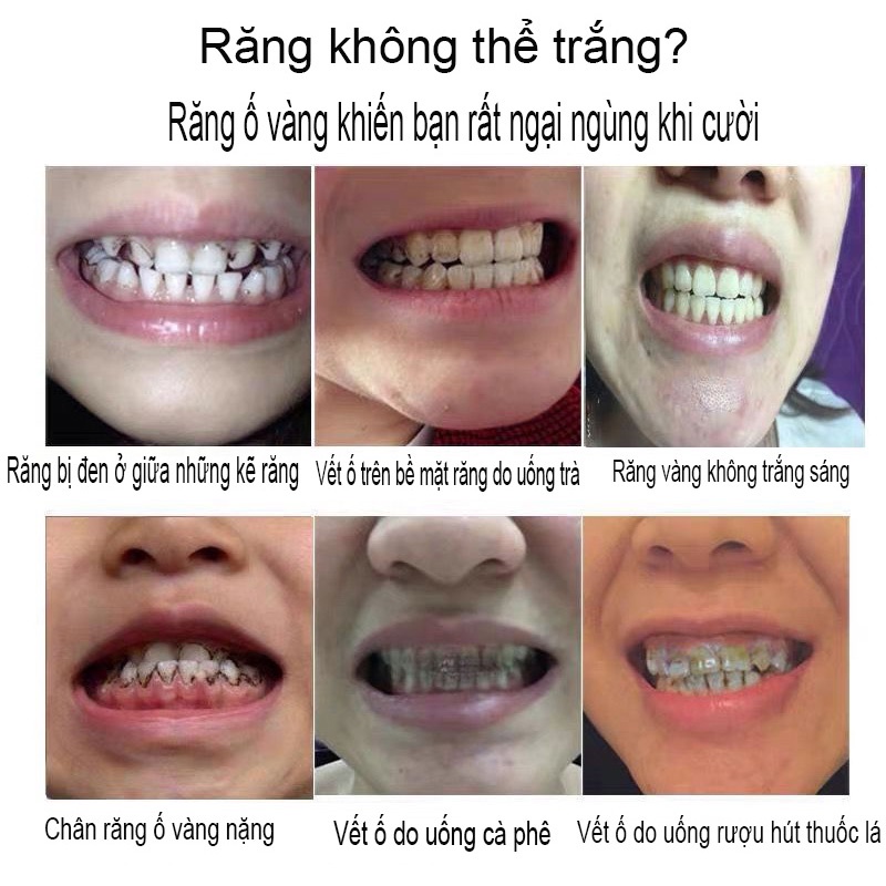 Kem Đánh Răng Làm trắng răng kem đánh răng 180g loại bỏ mảng bám trên răng nhanh chóng ố cao răng ngăn ngừa hôi miệng