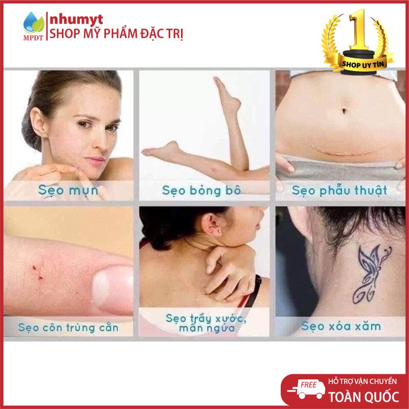 Kem mờ sẹo làm trắng da, mờ thâm sẹo | BigBuy360 - bigbuy360.vn